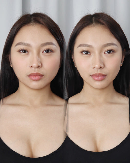 Masseter Botulin Lift & Glow