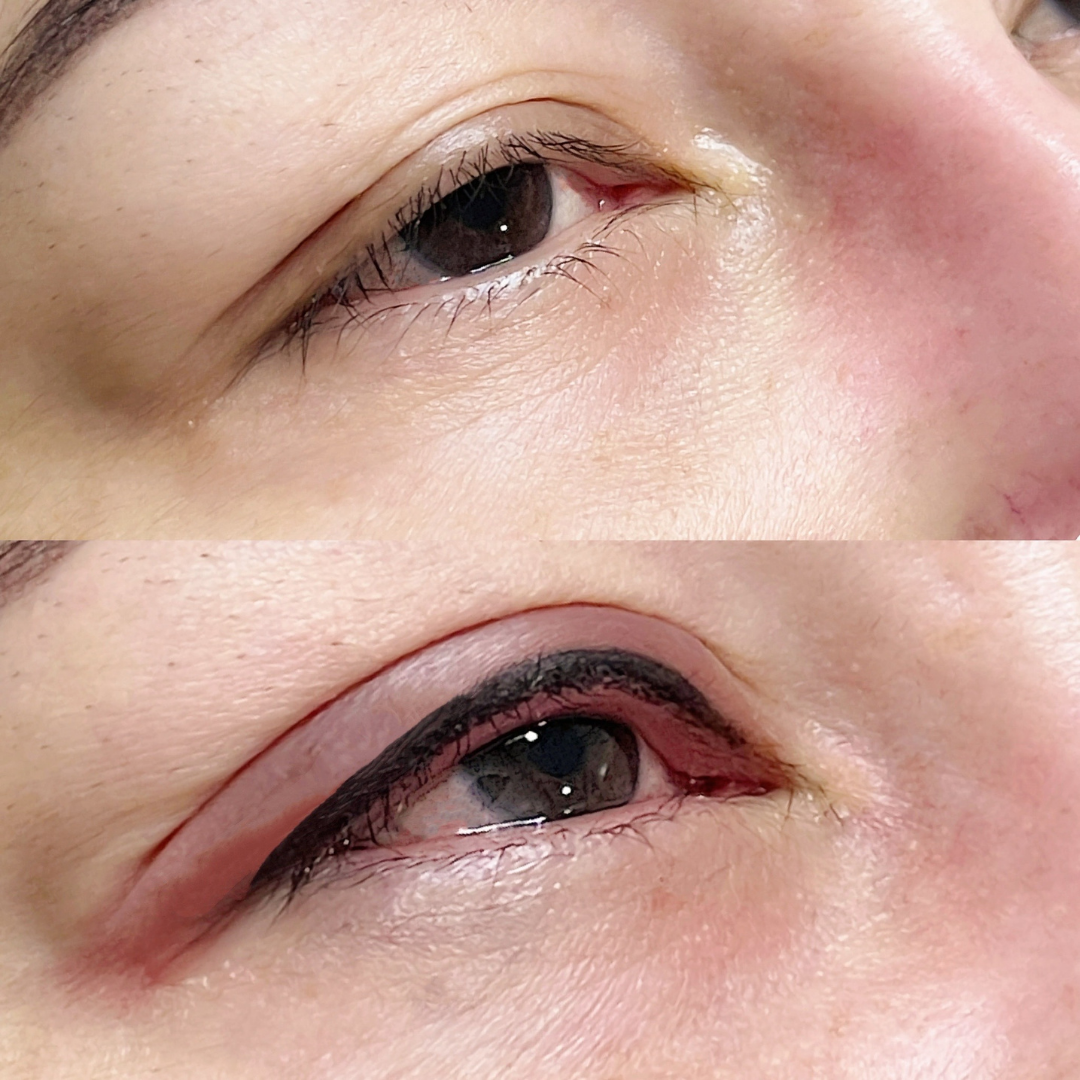 Permanent Eyeliner (micro-pigmentation)