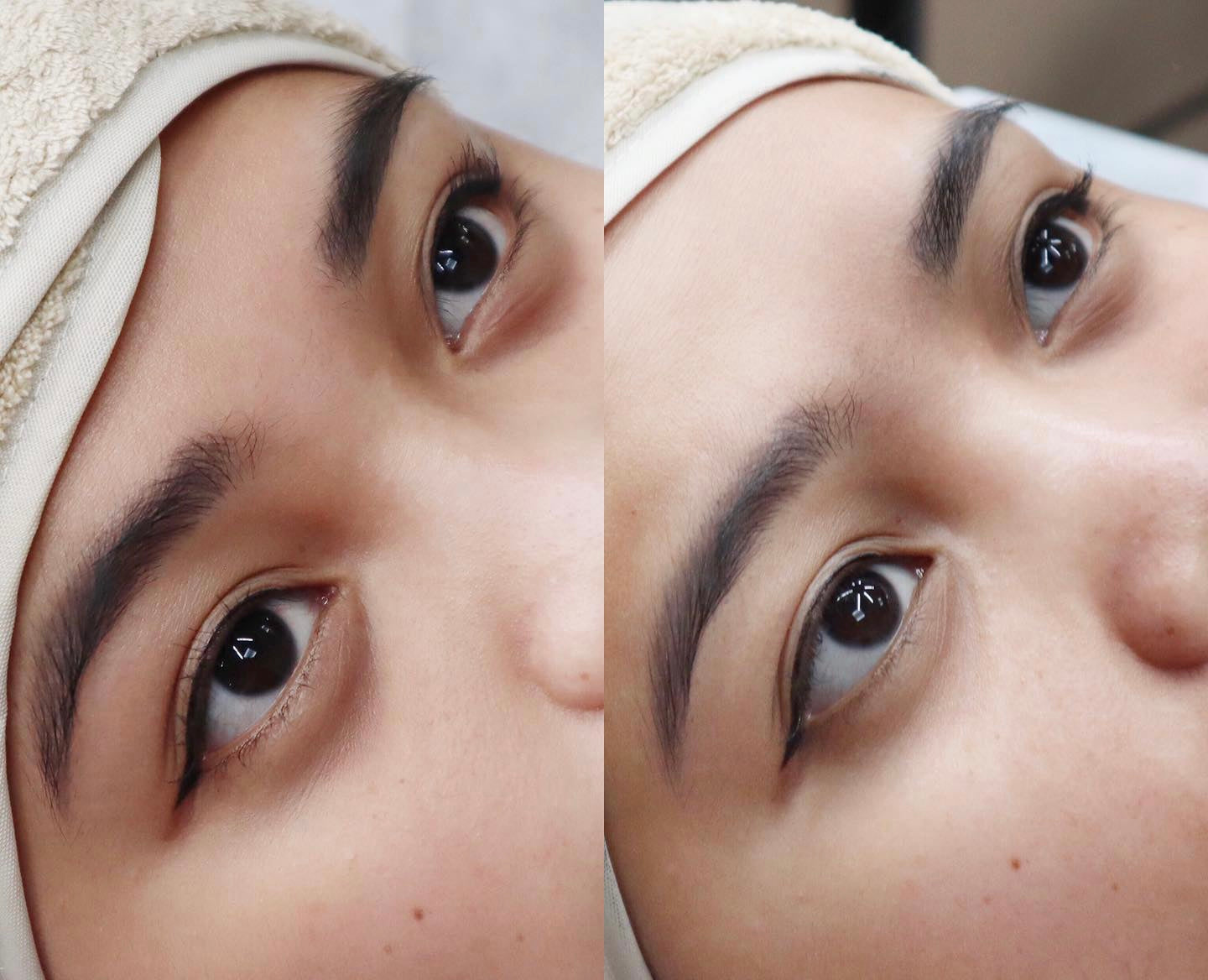 Black Pearl Facial Treatment