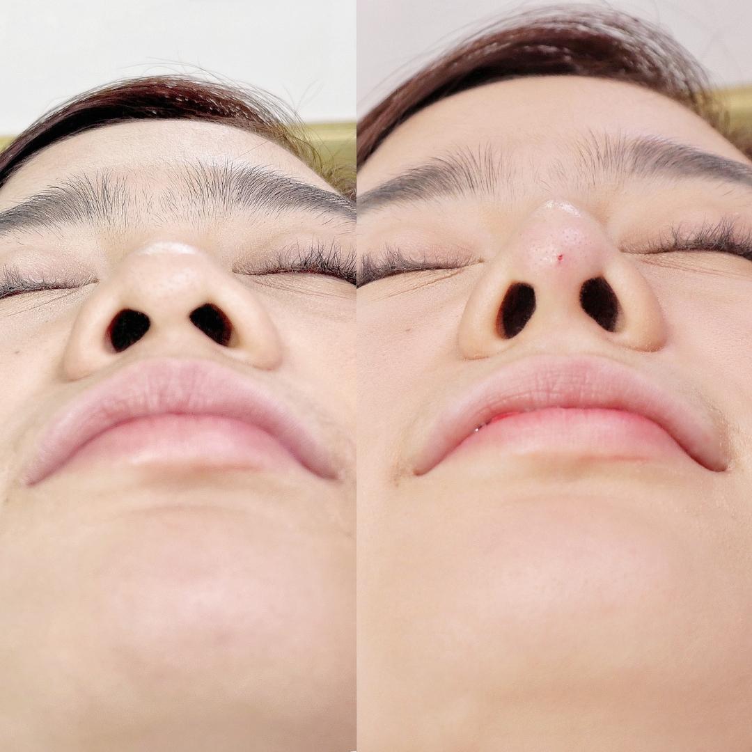 Nose Sculpture