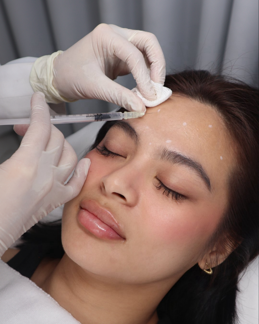 Anti-wrinkle Botulin Lift & Glow