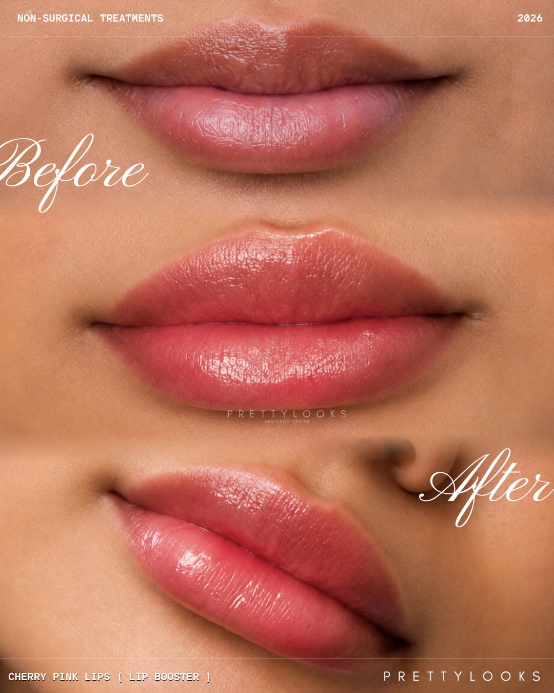 Cherry Pink Lips