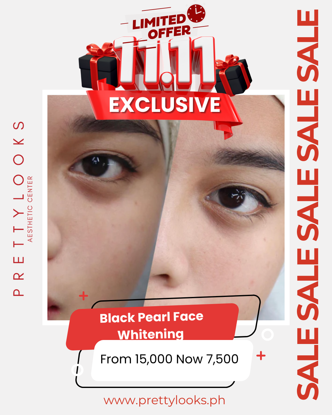 11.11 EXCLUSIVE SALE - Facial Glow Treatments 50% OFF