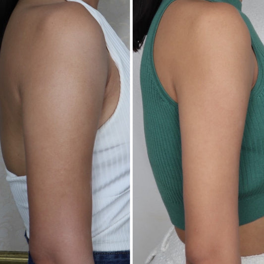 Slimmer Arms
