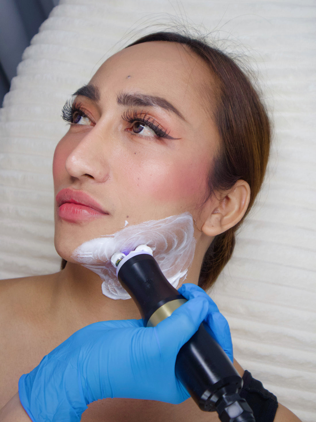 ThermaLift – Prettylooks Aesthetic Center