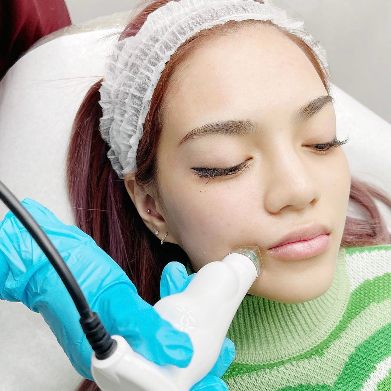 Collagen Blast Treatment Prettylooks Aesthetic Center