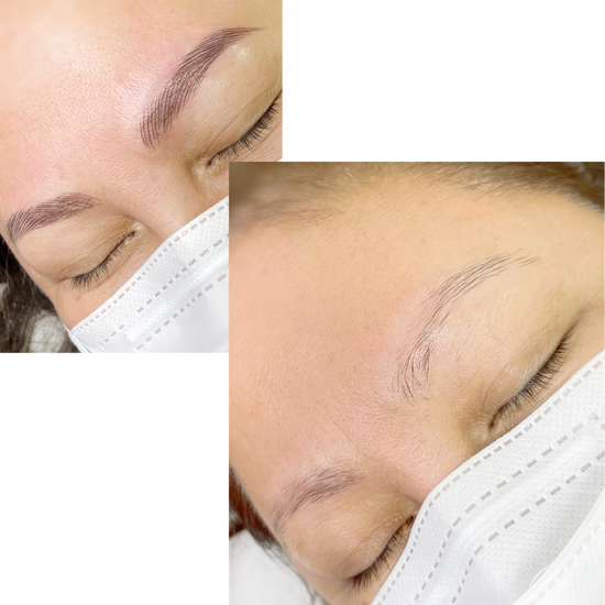 Eyebrow Etching (full stranding microblading) Prettylooks Aesthetic